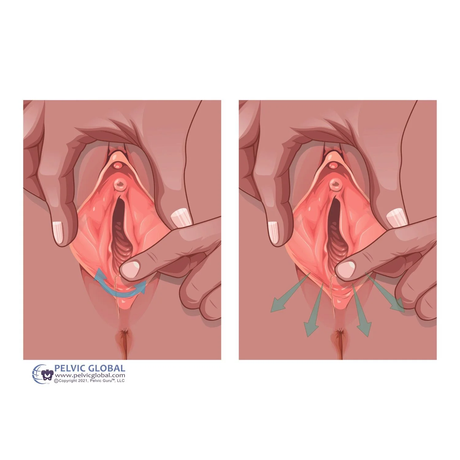 Perineal stretching technique
