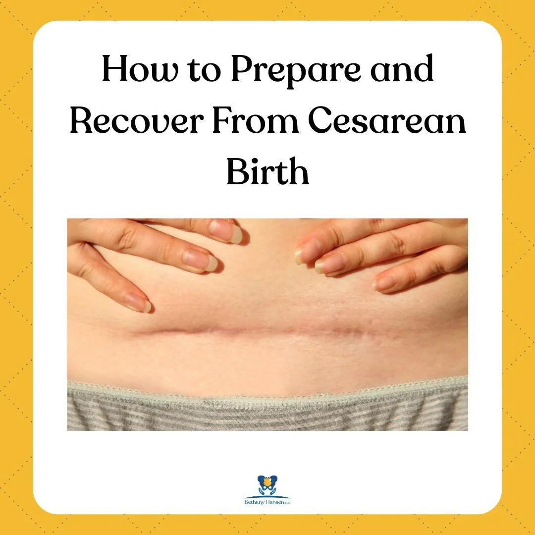 How to Prepare and Recover From Cesarean Birth