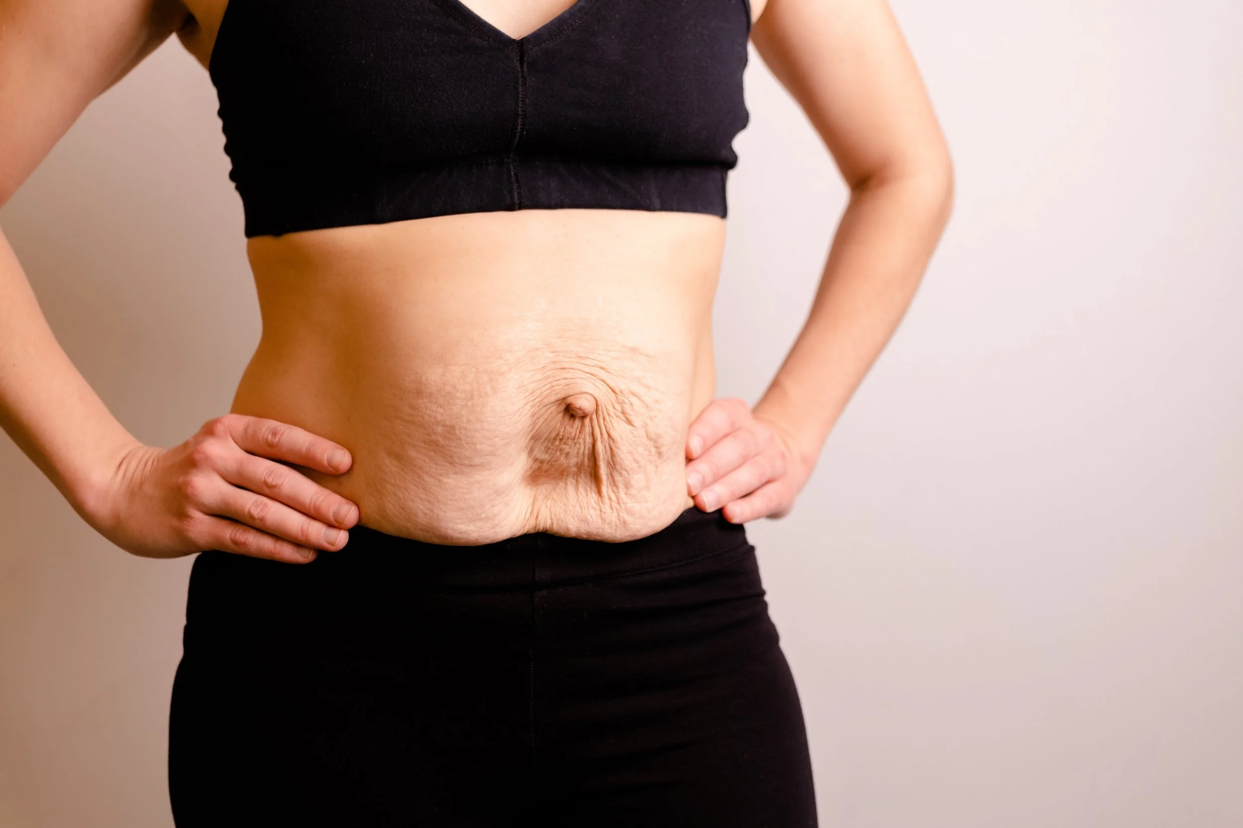 what to do for diastasis recti a pelvic floor pt perspective dra physical therapy bethany hansen edina minnesota 3