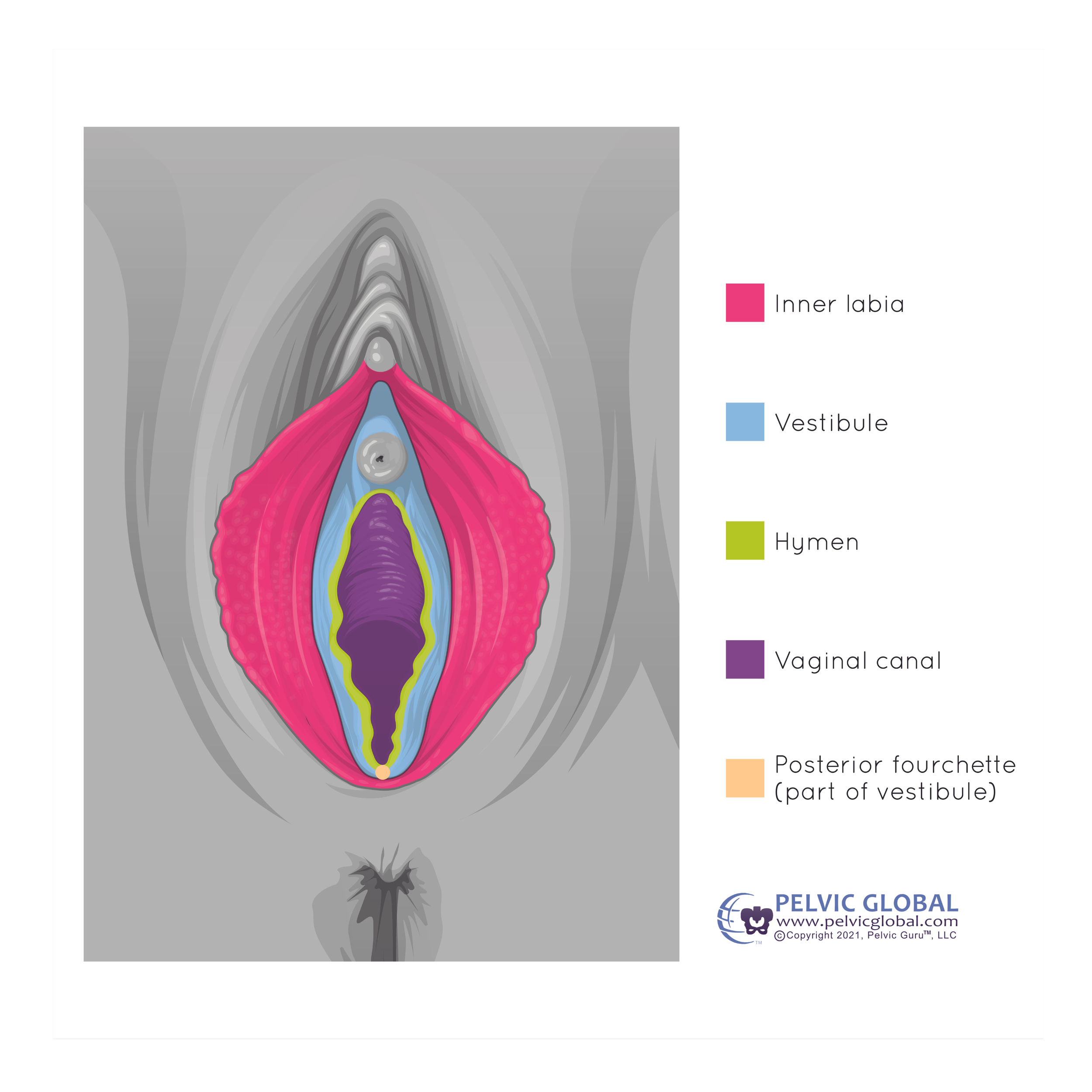 Image used with permission from Pelvic Guru®, LLC as a member of the Global Pelvic Health Alliance Membership (GPHAM)