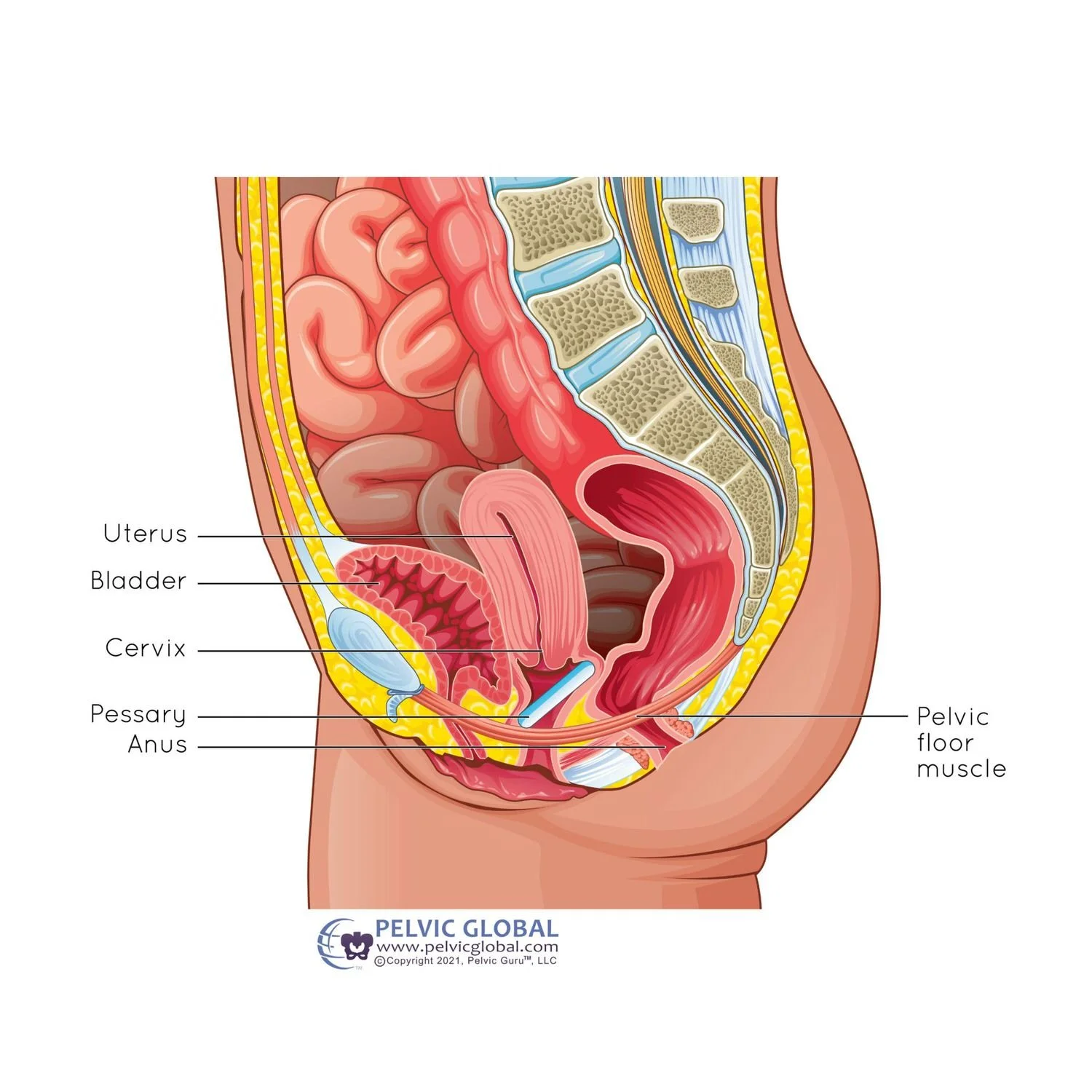 pessary prolapse pelvic floor physical therapy