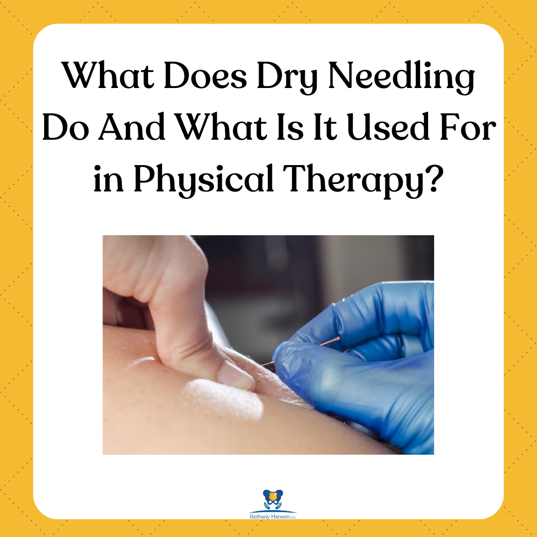 What does dry needling do