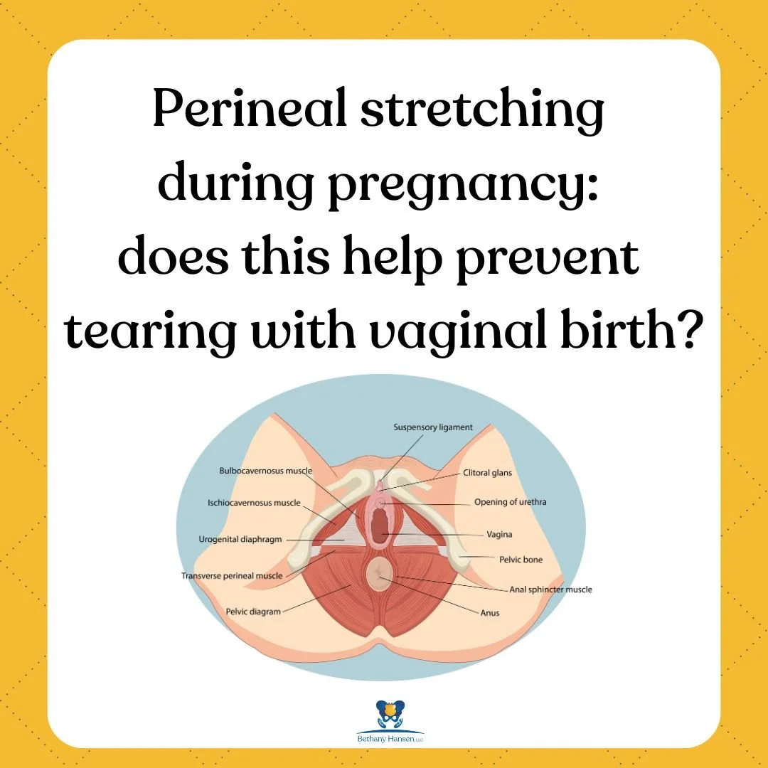 Perineal stretching during pregnancy: does this help prevent tearing  with vaginal birth?